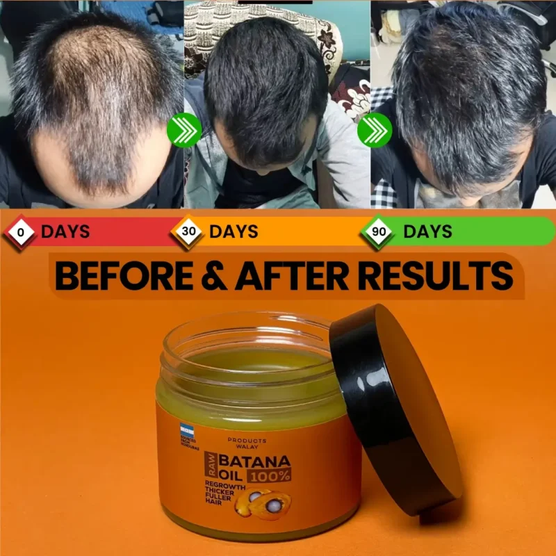 before and after results